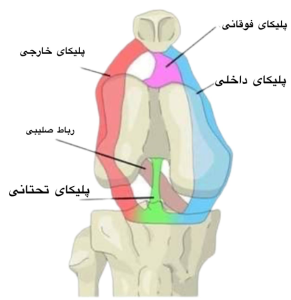 سندرم پلیکا
