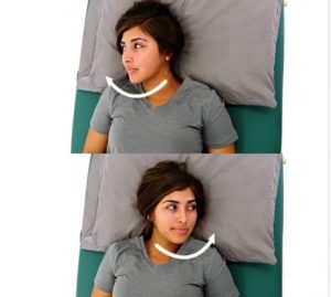 آرتروز گردن